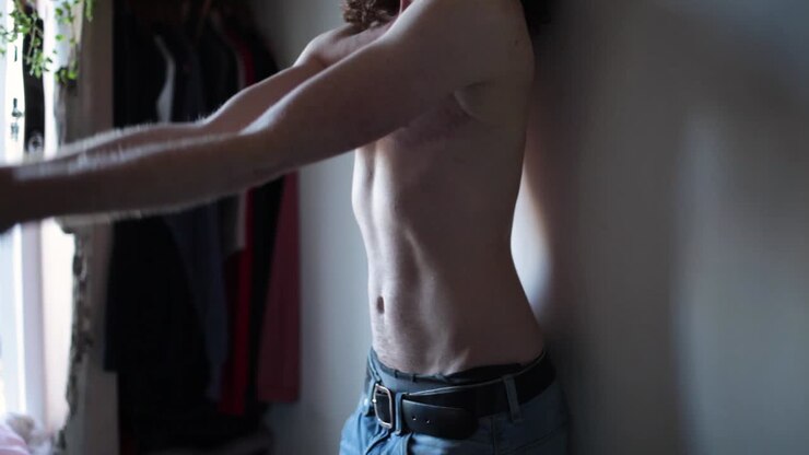 Uomo transgender che mostra cicatrici post-operatorie sul petto.