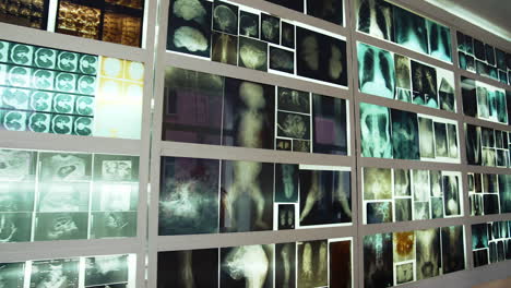 wall with multiple mri photos. many x-ray photographs showing people's bones. mri images including: head, neck, arm, foot, pelvis.