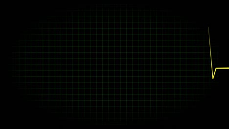 electrocardiograma osciloscopio forma de onda animación gráficos de movimiento