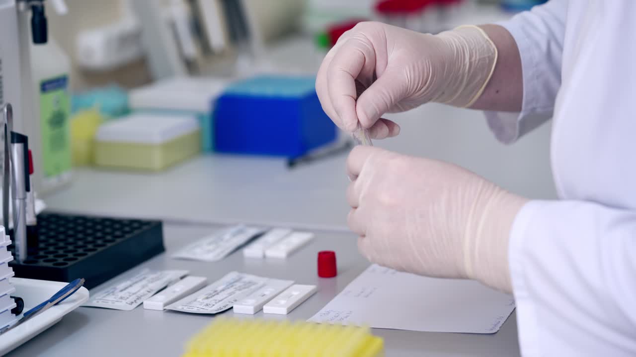 Medical assistant works with samples. Hands of medical worker in sterile gloves uses pipette during test analysis in the laboratory.