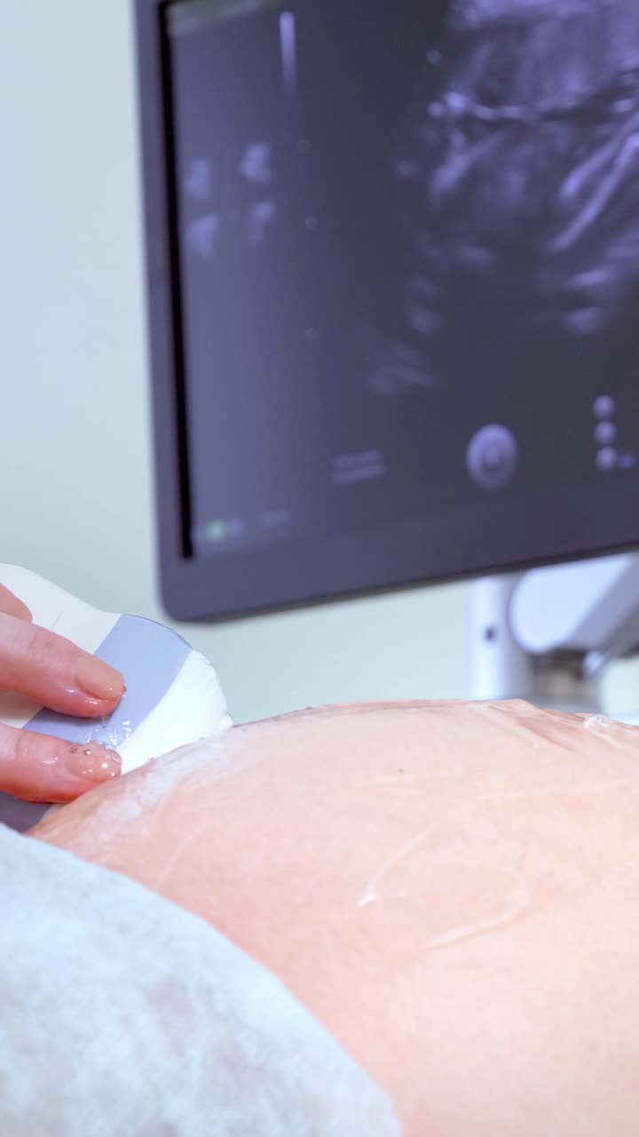 Professionista medico che esegue un'ecografia su un paziente con monitor che mostra i risultati