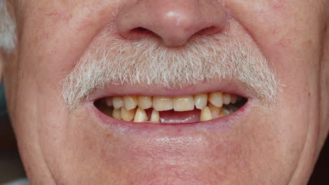 Toothless-male-smile-mouth-of-senior-elderly-old-man,-dental-problem,-bad-rotten-teeth-loss,-caries