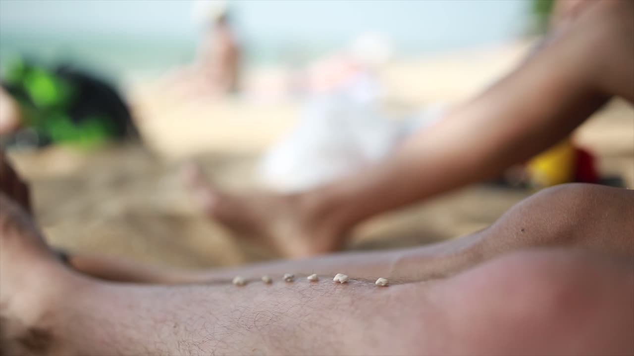 pequeñas protuberancias en las piernas en la playa