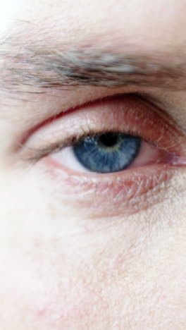 close-up of patient eye