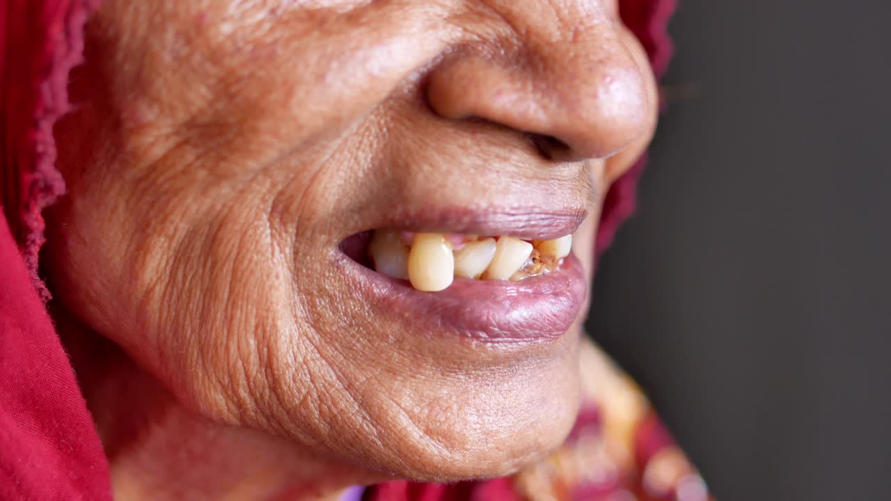 Close-up di carie dentali di donne anziane e alcuni denti rotti