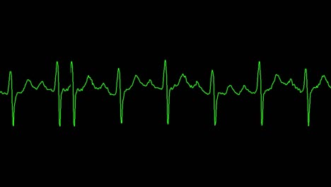 ecg shows sinus tachycardia