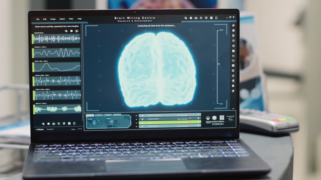 Laptop che mostra la diagnosi del cervello umano