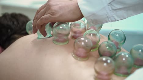 cupping therapy session