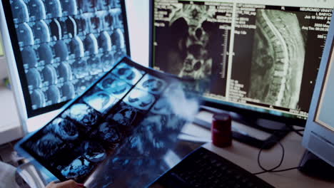 doctor looking at x rays. doctor examining chest x ray film of patient at hospital