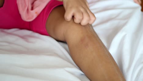 child girl suffering from itching skin, close up