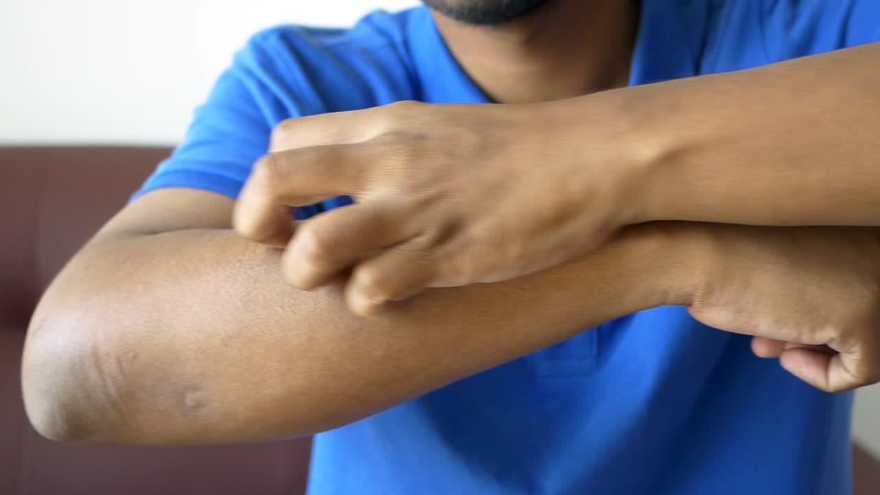 Man scratching his arm