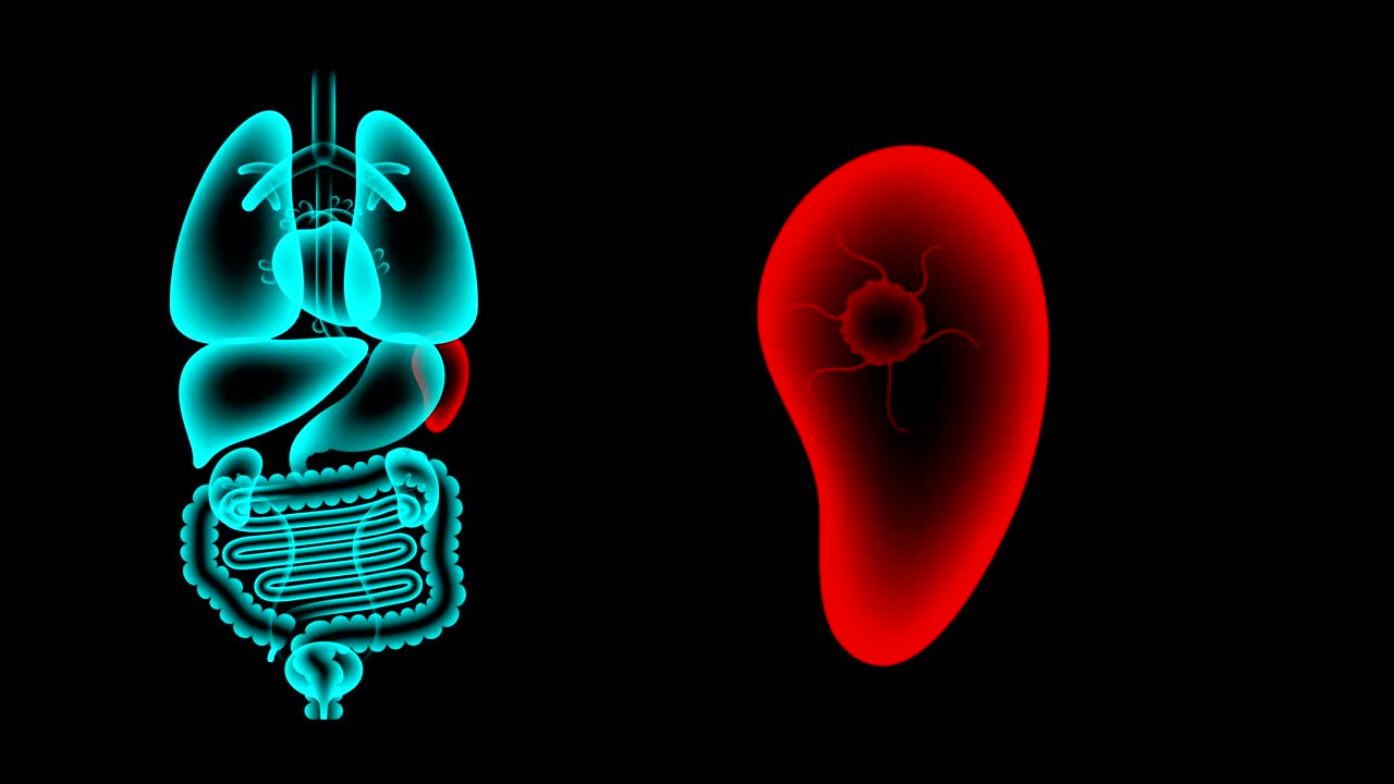 conjunto de rayos x de órganos masculinos, infección del bazo idea concepto ilustración de color rojo brillo aislado en el fondo oscuro, animación de bucle sin costuras 4k con espacio de copia