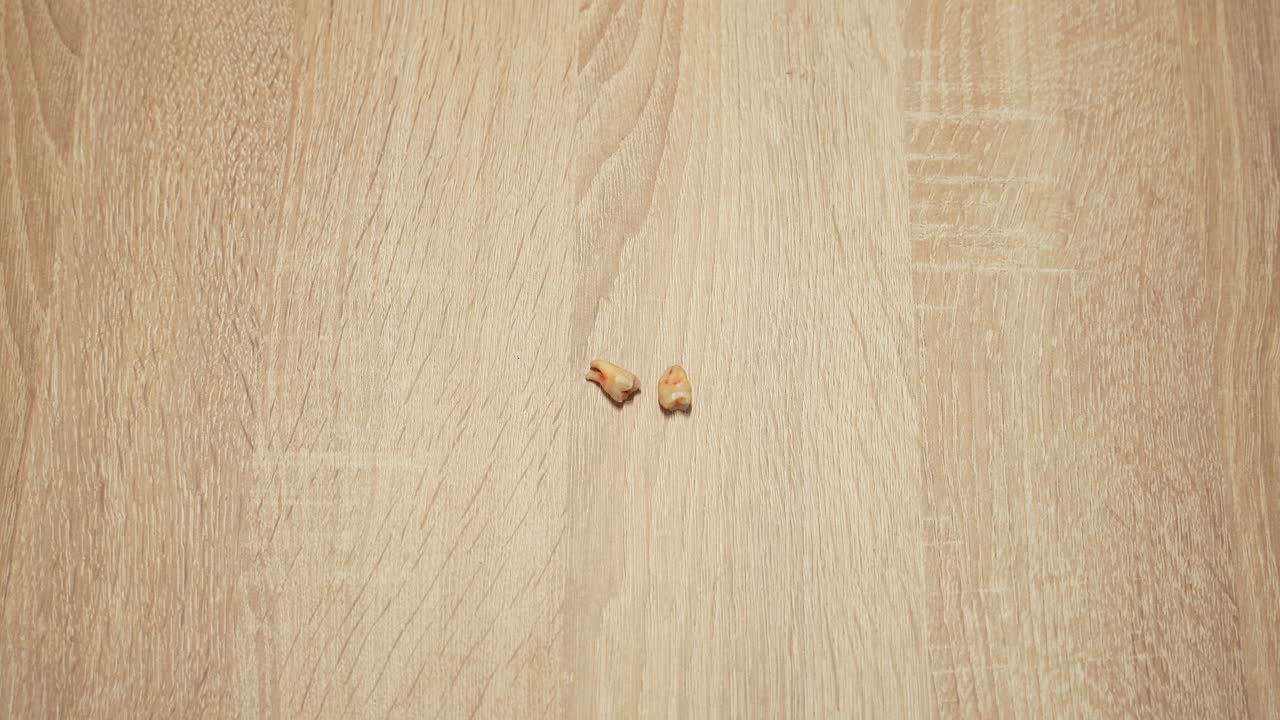 마른 피로 새로 뽑은 두 개의 지혜 치아, 확대