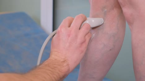 a vascular surgeon performs an ultrasound examination of a patient’s veins. prevention of varicose veins, thrombosis, rosacea.