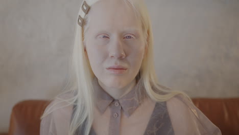Portrait of a Woman with Albinism