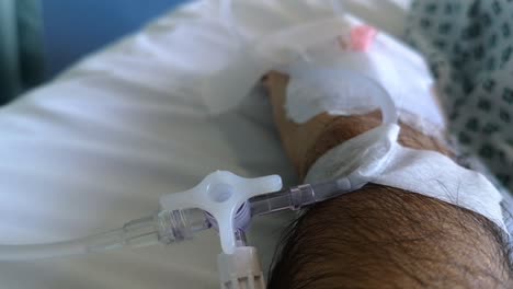 vista cercana del brazo de un paciente en el hospital con una vía intravenosa de cloruro de sodio