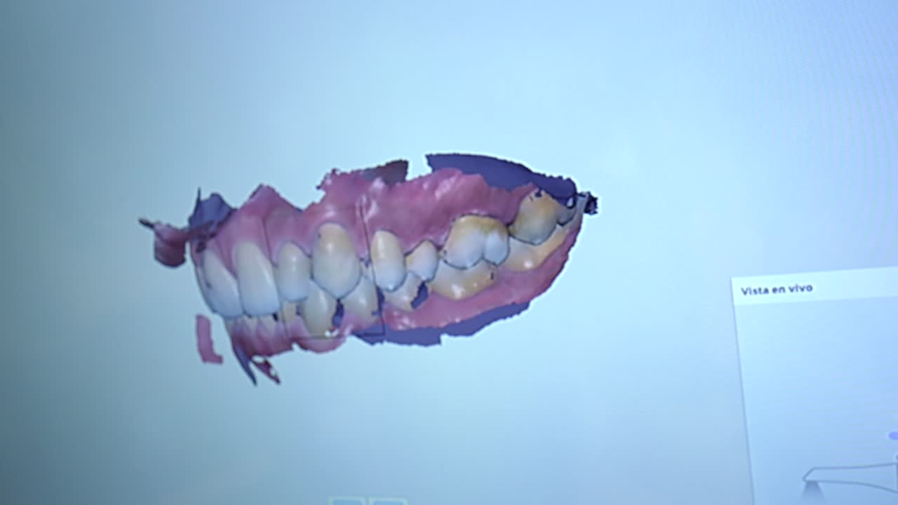 Dental Scan 3D Model