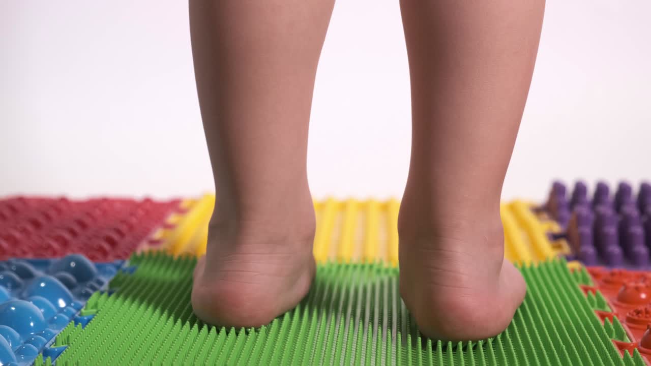 Children's legs close-up, valgus foot positioning