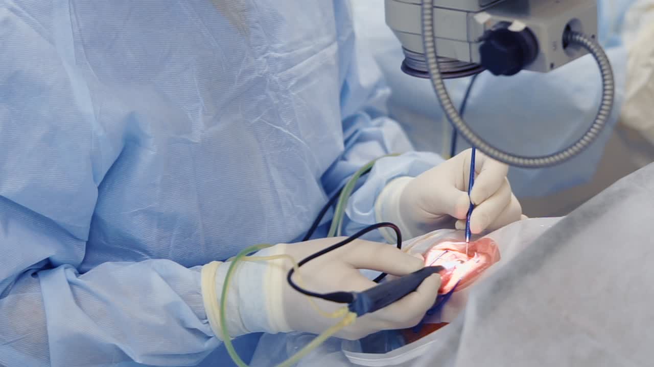 procedimiento de cirugía ocular