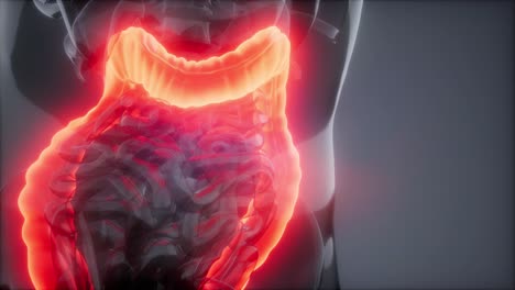 examen de radiología del colon humano