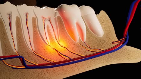 dolor de dientes. sección anatómica detallada de los dientes. inflamación del nervio. animación en 3d