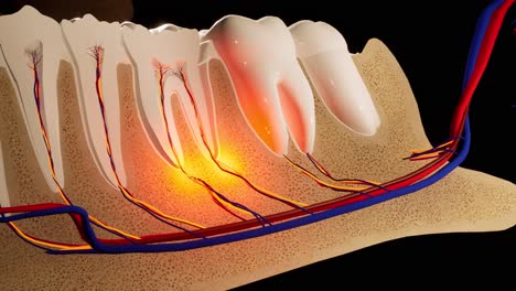 toothache. anatomical detailed section of the teeth. nerve inflammation. 3d animation