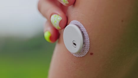 hand on glucose monitoring device, healthcare inequality, emotional struggle