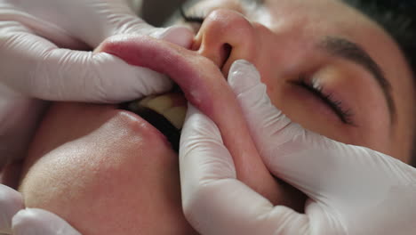 close up of woman upper lips being massaged by therapist wearing protective gloves performing precise lip massage under lamp for stimulating pressure and soothing therapy in relaxing spa environment
