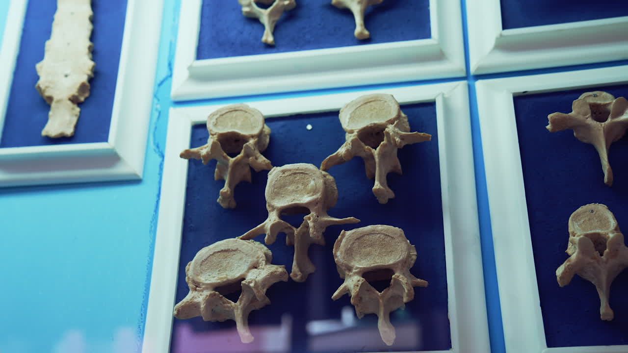 Parts of bones on the wall. Dummies of human bones. Artificial bones.