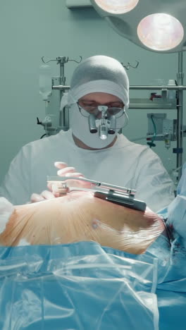 el médico expande el pecho del paciente con un retractor en la habitación. el cirujano de cardiología abre la herida para realizar una cirugía de derivación de la arteria coronaria en una clínica moderna