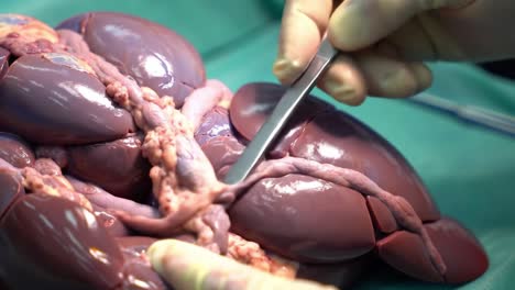 detailed examination of organ anatomy: surgical dissection of renal structures revealing complex vascular connections and tissue composition in clinical setting