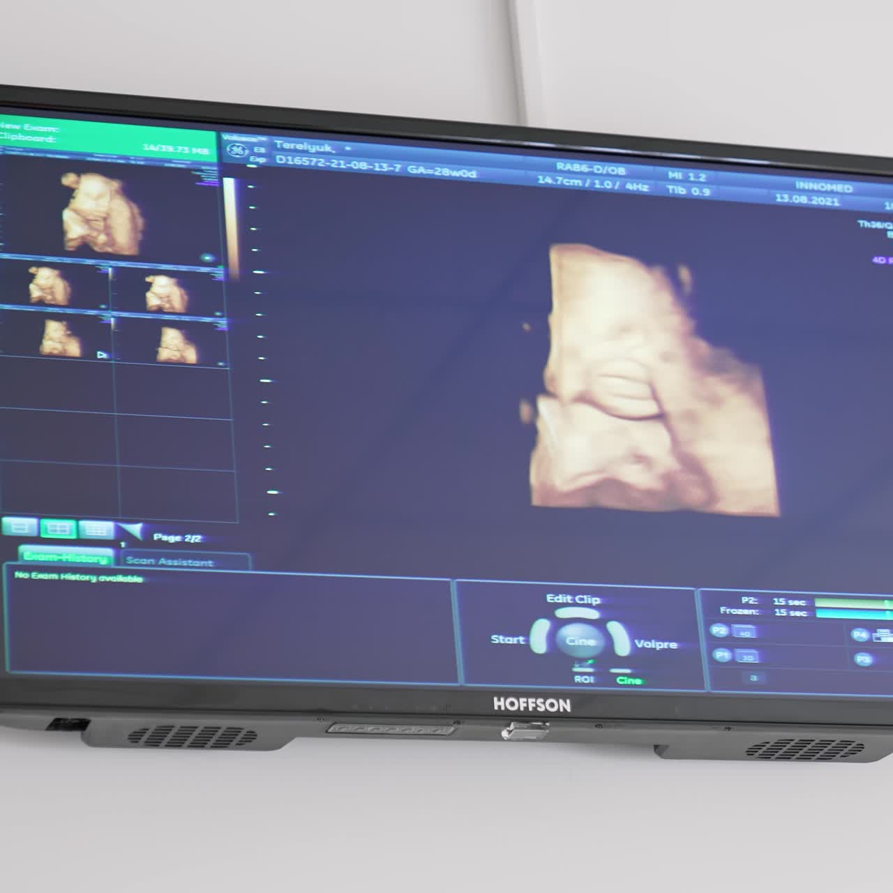 Ultrasound baby in a mother's womb. Ultrasound of pregnant woman. Scientific analysis