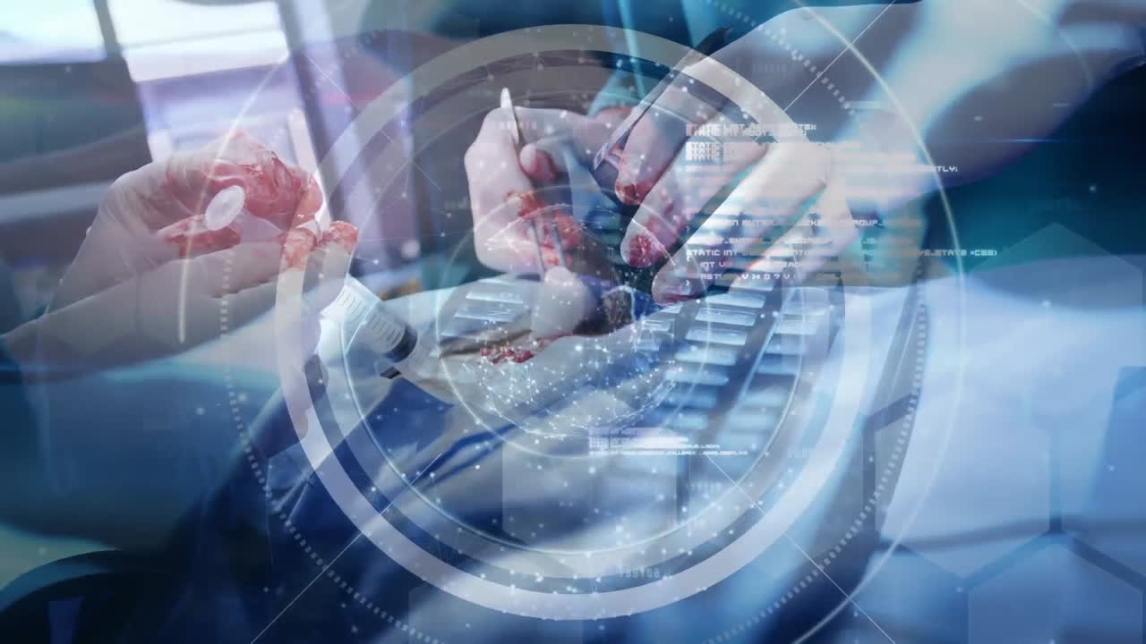 수술실의 외과 의사들에 대한 연결 네트워크와 함께 지구의 애니메이션