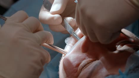 procedimiento dental