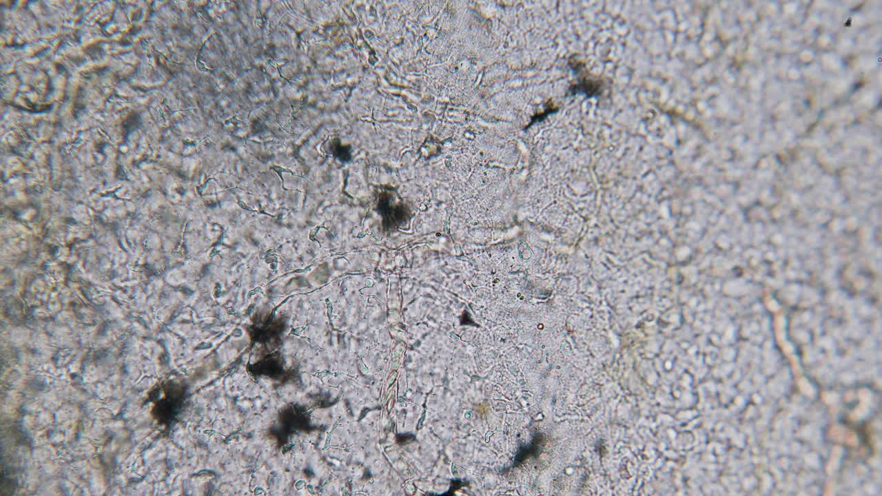 sangre movimiento de eritrocitos en vasos sanguíneos capilares microscopía