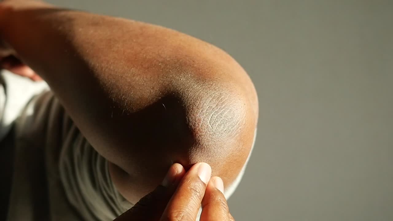 cerca del codo seco de una persona