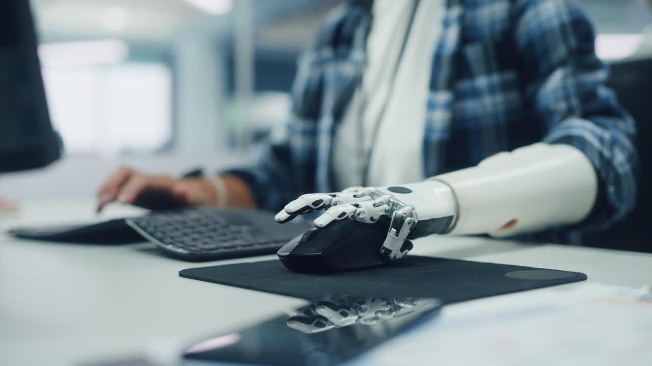 Inclusive Office: Person with Disability Using Prosthetic Arm to Work on Computer. Professional with Advanced Thought Controlled Body Powered Myoelectric Bionic Limb to Control Mouse. Focus on Hands