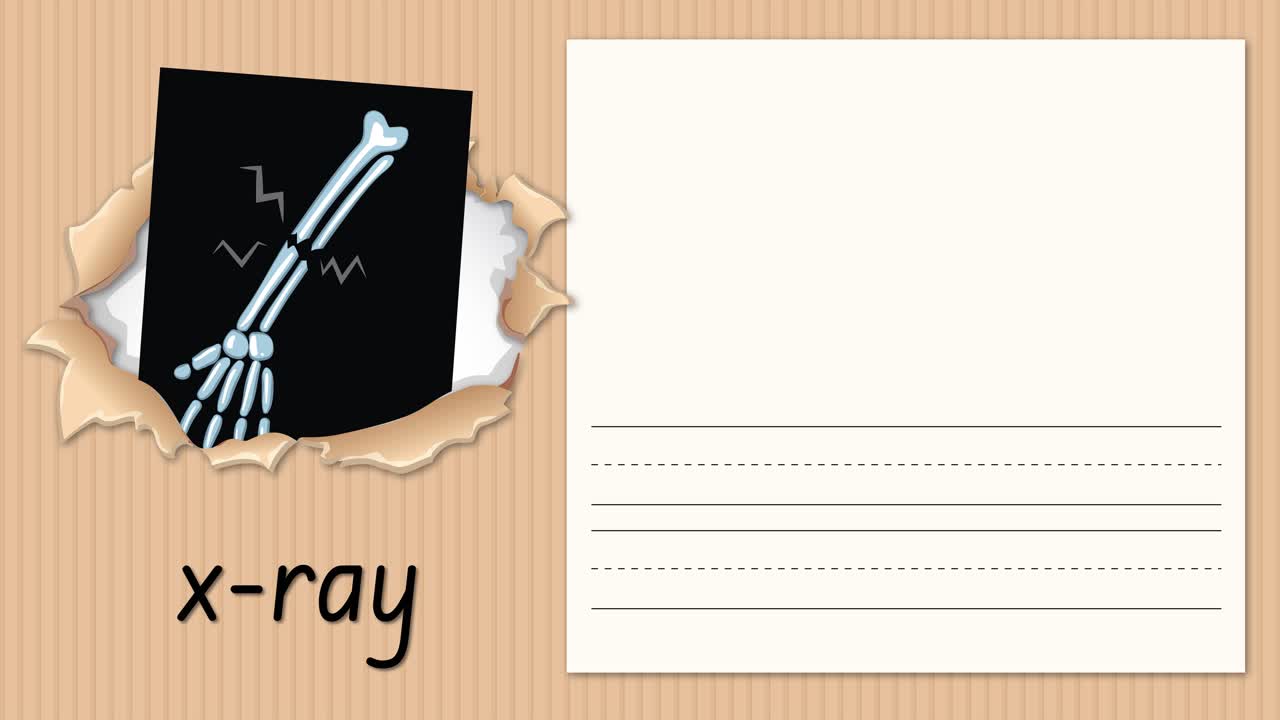 Animated educational video demonstrates writing the letter X alongside an illustrative x-ray image