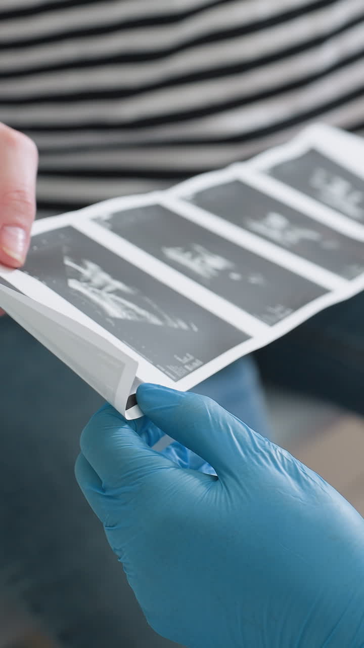 Primer plano de unas manos enguantadas que examinan impresiones de ultrasonido. Un ecografista señala una tira de ecografía fetal mientras una paciente de piel blanca con una camisa a rayas observa, guantes de látex azules que manipulan la película, entorno clínico, enfoque.