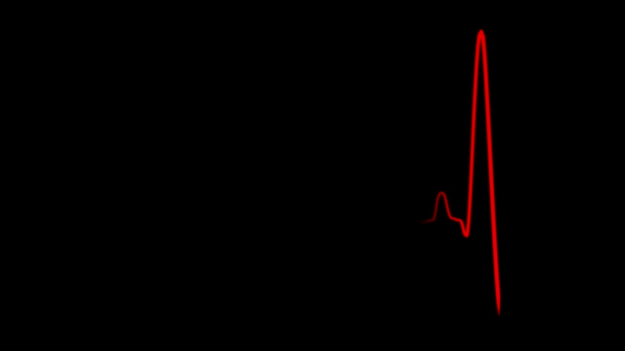 Cardiograma, cardiógrafo, pantalla de osciloscopio, bucle 4K