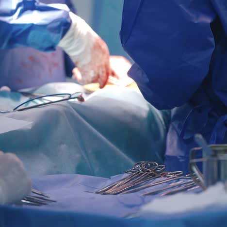 medical scissors in surgery background. doctors perform an operation. specialists' gloves in blood of during surgery. surgical tools.