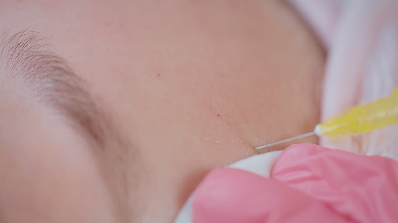 얼굴 주사 절차