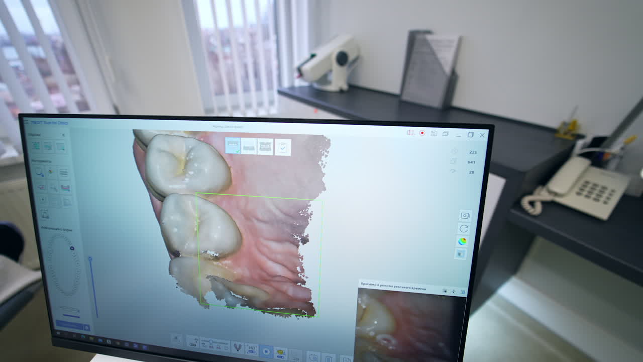 Dental 3D Scan Image