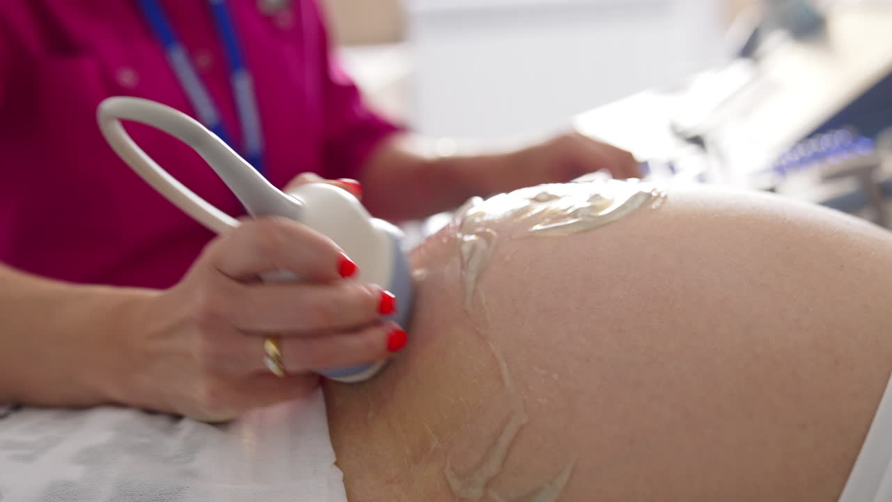 Close-up Shot of the Doctor does Ultrasound. Sonogram Procedure to a Pregnant Woman.