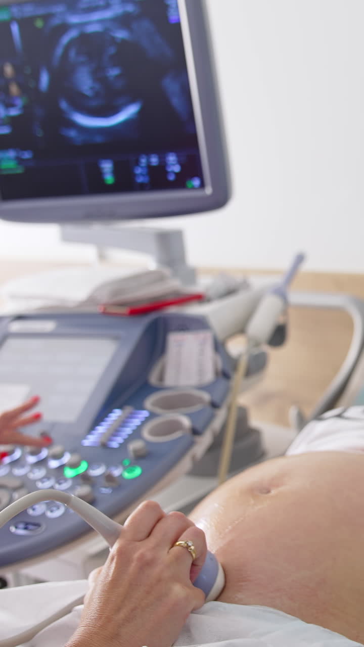 Pregnant woman doing ultrasound in clinic. Doctor doing ultrasound on belly in clinic. Process of fetus ultrasonography. Pregnancy concept. Vertical video