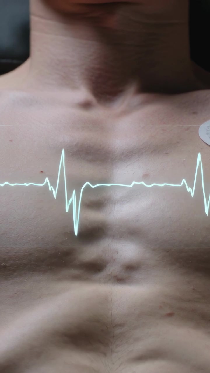 Video vertikal: EKG dimulai dengan lonjakan bergerak melintasi dada telanjang di tempat tidur, elektroda memantau jantung