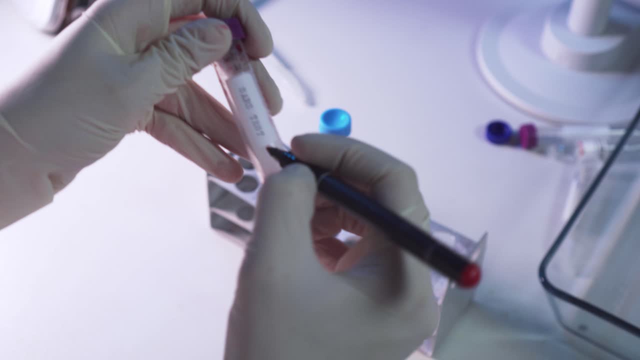 Marker in hand marking sars test tube with blood, closeup view