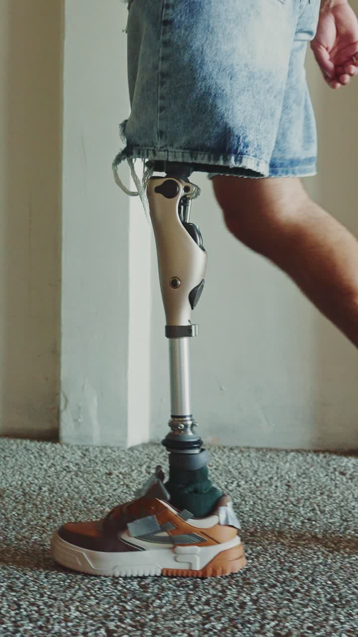 Person with Prosthetic Leg Walking