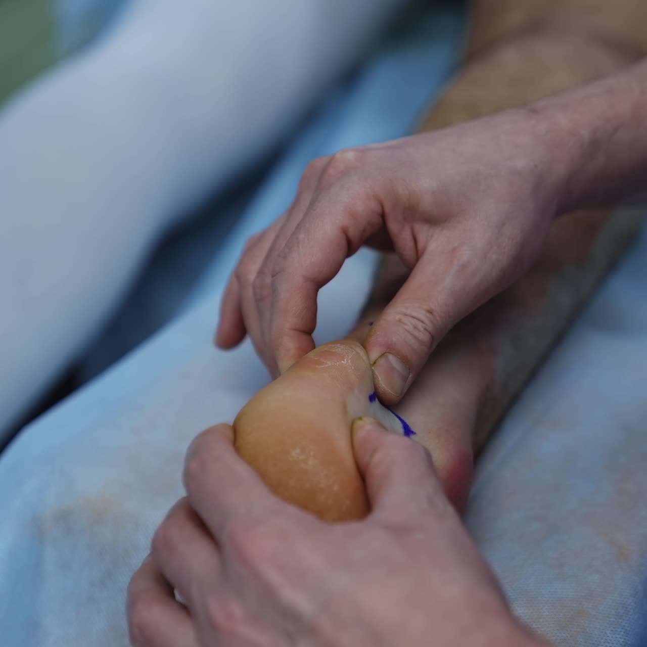 Mani del chirurgo che ispezionano la gamba del paziente. Il medico prepara la gamba prima dell'operazione. Procedura medica in clinica. Primo piano