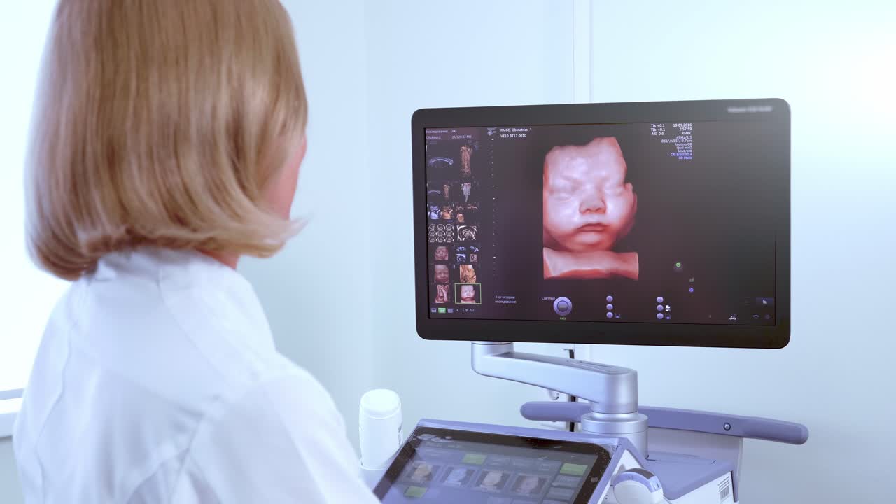 3D Ultrasound Scan of a Fetus